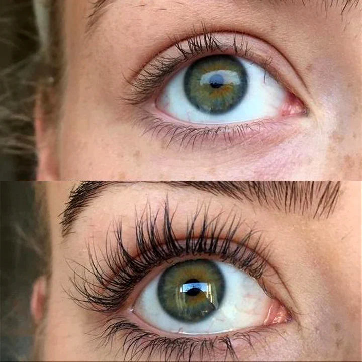 Before and after photo showing dramatic eyelash growth and volume enhancement with QUALASH Advanced Eyelash Serum